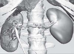 Chuyên gia mách 8 nguyên tắc vàng giúp khỏi bệnh thận