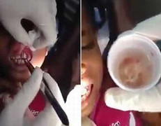 Hàng chục con giòi bò lúc nhúc trong mồm bé gái