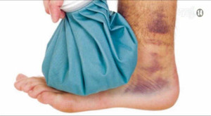 Sơ cứu những tai nạn khi chen lấn trong đám đông