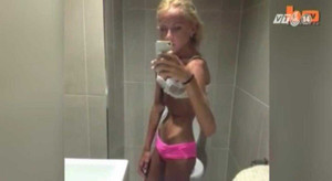 Clip: Thiếu nữ suýt chết vì muốn giống người mẫu