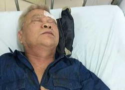 Xem chơi cờ, cụ ông 76 tuổi bị đánh nhập viện