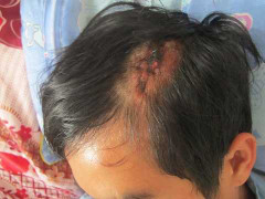 Hành khách tố bị nhà xe dùng tuýp sắt đánh bất tỉnh