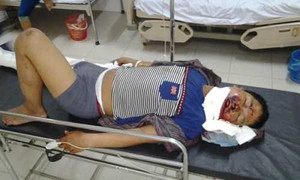 Liên tiếp những vụ tai nạn lao động nghiêm trọng ở Formosa