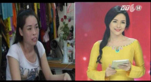 Tâm sự của cô gái Nam Định xinh như mộng sau phẫu thuật từng gây 'sốc'