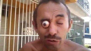 Kinh dị người đàn ông tự đẩy mắt lồi ra