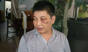 Chó Pit bull cắn chó Labrador tới chết: Người ngăn cản bị đánh lên tiếng