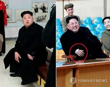 Nghi vấn về 'vật lạ' trên cổ tay ông Kim Jong-un