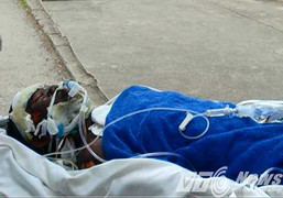 Công an vào cuộc vụ 6 nạn nhân bị bỏng nặng bất thường ở Quảng Ninh