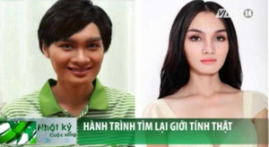 Việt Nam có thể thực hiện được phẫu thuật chuyển giới