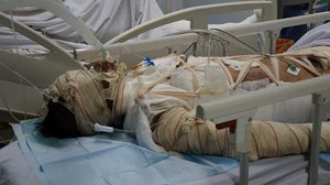 Lao vào biển lửa cứu con, mẹ bị cháy như đuốc