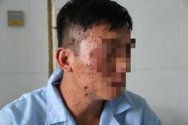 Con trai kể lại giây phút kinh hoàng vụ bố ôm mìn vào phòng kích nổ