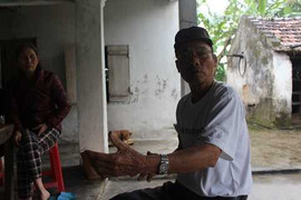 Giây phút đối mặt kẻ trộm chó và cú nã súng bất ngờ vào đầu