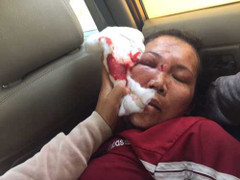 Cả nhà công an xã đánh một phụ nữ ngất xỉu để đòi nợ