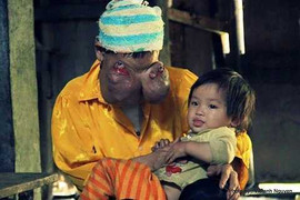 Đau xé lòng: 'Bà quái vật ơi, đừng chết!'