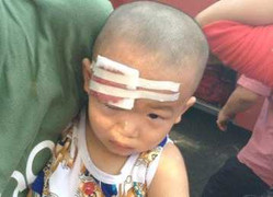 Xe khách bị ném đá vỡ kính, bé 23 tháng tuổi trọng thương