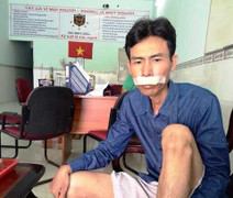 Côn đồ đập phá chốt trực, tấn công bảo vệ: Lâm 'chó lửa' thừa nhận