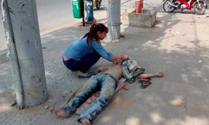 Say nắng, một người bị rối loạn tâm thần, hôn mê