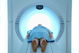 Bí quyết sống khỏe sau hóa trị, xạ trị ung thư