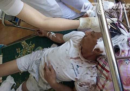 4 ngày xảy ra 3 vụ côn đồ truy sát người dân ở Hải Dương