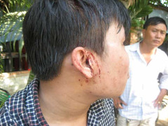 Phóng viên Báo Giao thông bị đánh, cướp máy quay khi tác nghiệp