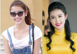 Nhan sắc á hậu Huyền My bớt xinh sau khi nhổ răng khểnh