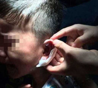 Giáo viên dùng dập ghim bấm tai học sinh mẫu giáo