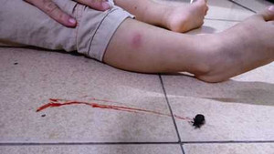 Xuất hiện bọ xít hút máu người ở Ninh Thuận