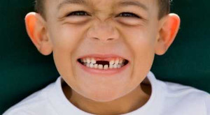 Hiểu về quá trình thay răng của bé