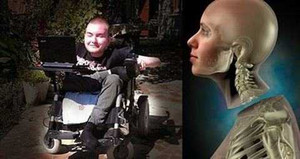 Bí ẩn chuyện ghép đầu người