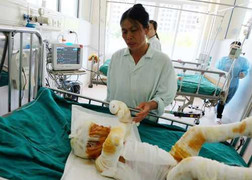 Nổ khí gas 4 người bỏng nặng: Buổi sáng kinh hoàng của gia đình nhỏ