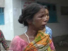 Phẫn nộ bà mẹ nghiện rượu cắt da đầu, ăn thịt con gái 2 tuổi