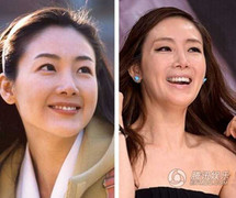 Mỹ nhân Hàn Choi Ji Woo, Kim Hee Sun mặt cứng đờ, biến dạng vì thẩm mỹ