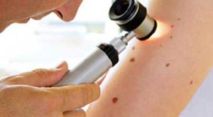 11 dấu hiệu cảnh báo ung thư sớm