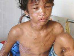 Hào Anh và câu chuyện từ thiện đúng cách