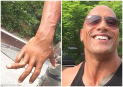 ‘The Rock’ đăng ảnh gãy ngón tay dọa fan