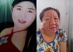 Kỳ lạ cô gái 29 tuổi biến thành bà lão 70 sau khi sinh con