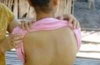 Cách phòng và điều trị cong vẹo cột sống ở trẻ nhỏ