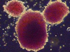 Tế bào gốc có thể ứng dụng điều trị những bệnh nào?