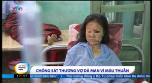 Video: Lạnh người vụ bạo hành cắt gân tay, chân qua lời kể người vợ