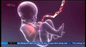 Lưu trữ máu cuống rốn chữa bách bệnh