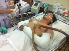 Diễn viên bị nạn trong phim của Ưng Hoàng Phúc qua đời