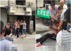 Clip: Kinh hoàng pháo hoa phát nổ trong nhà, người đàn ông cụt tay