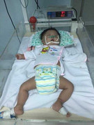 Xót xa bé gái sơ sinh mắc bệnh Down bị mẹ bỏ lại bệnh viện