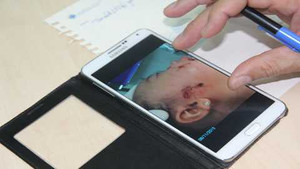 Trẻ em bị chó cắn: Đuổi theo chó lấy lại môi cho con