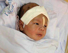 Bé trai 12 ngày tuổi bị đâm xuyên não sắp được xuất viện