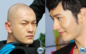 Ảnh ngày ấy - bây giờ tố Huỳnh Hiểu Minh, Lâm Phong thẩm mỹ