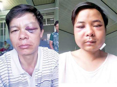 Ba cán bộ kiểm lâm bị lâm tặc đánh đập, bắt quỳ