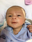 Ngày mai bé trai bị đâm xuyên não sẽ xuất viện