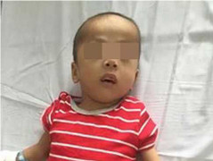 Bé trai 5 tuổi bị chó cắn đứt dương vật, không thể nối lại