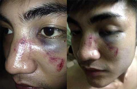 Đà Nẵng: Dân 'tố' bị công an phường đánh nhập viện